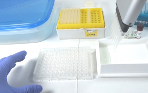 ELISA test